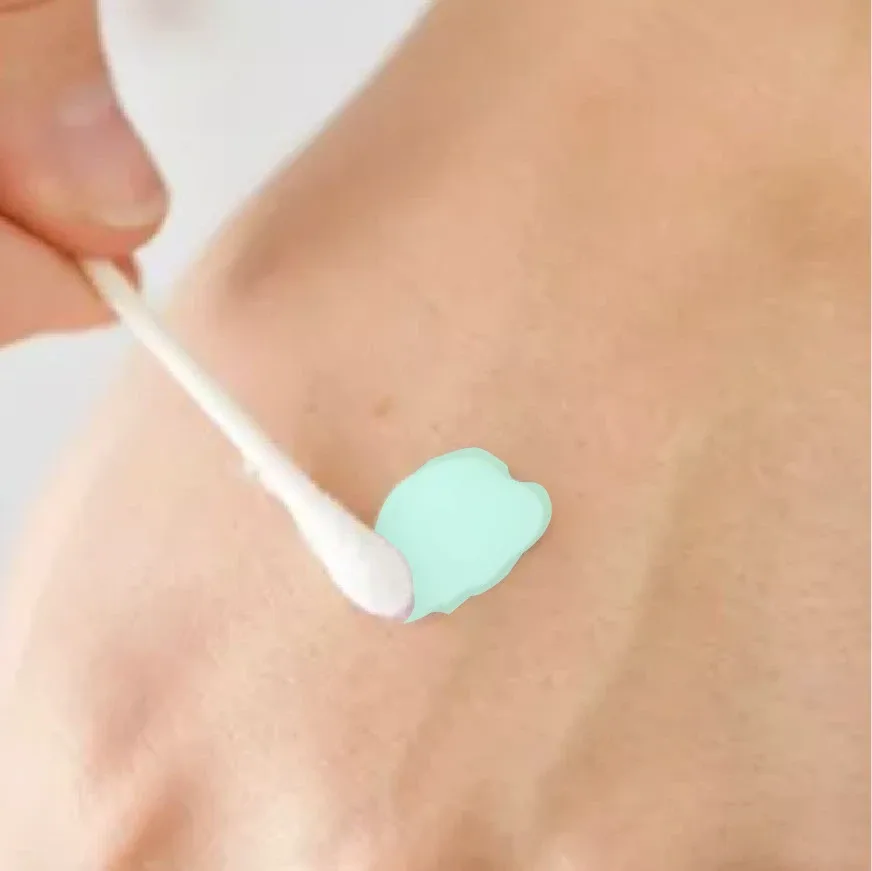 Cotton bud applying mint cream to skin